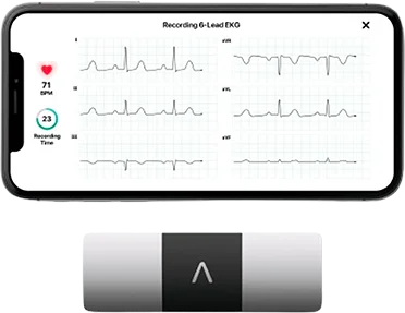 Mini-ECG portable